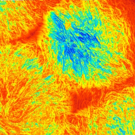 Spherulites, oscillating mode, 20µm