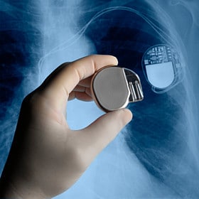 Medical devices image