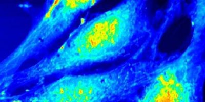 Fibroblastes embryonnaires, mode oscillant, 80 µm